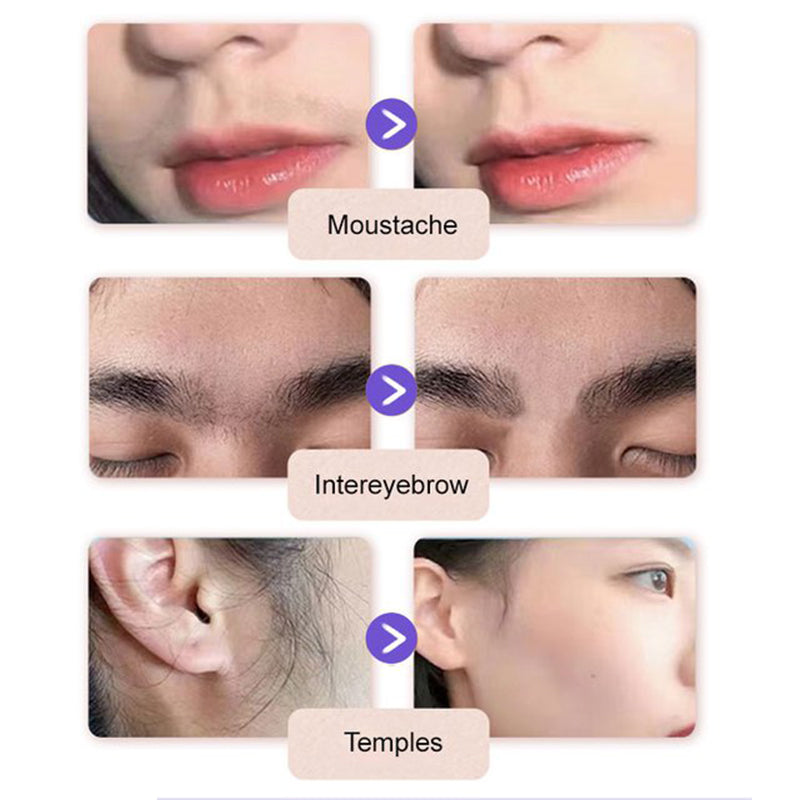 ⏰ Now only 50% off!🔥Buy 2 Get 1 Free🔥Gentle and Painless Facial Hair Removal Cream